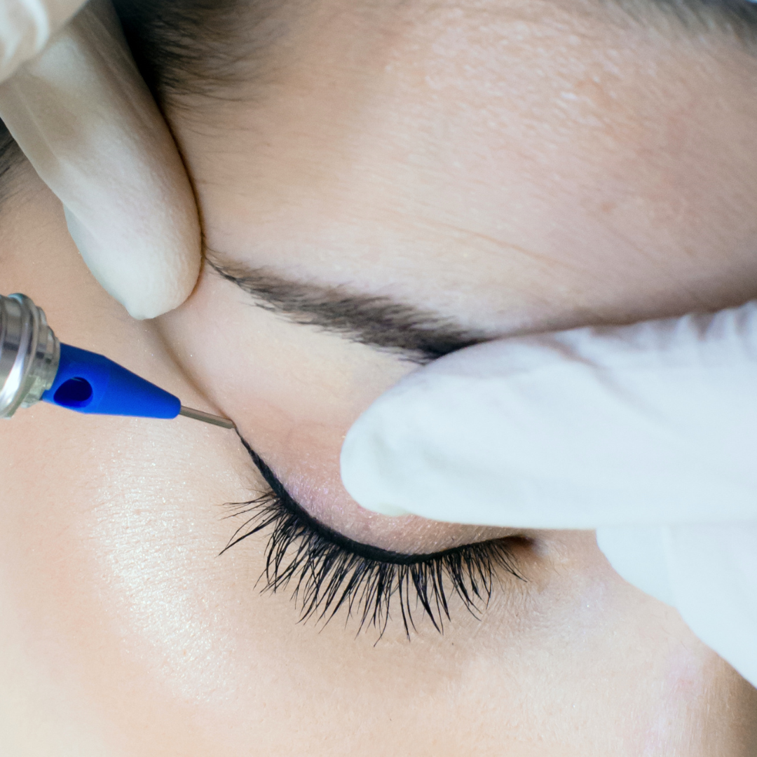 6 Secrets of Perfect Eyelash Extensions