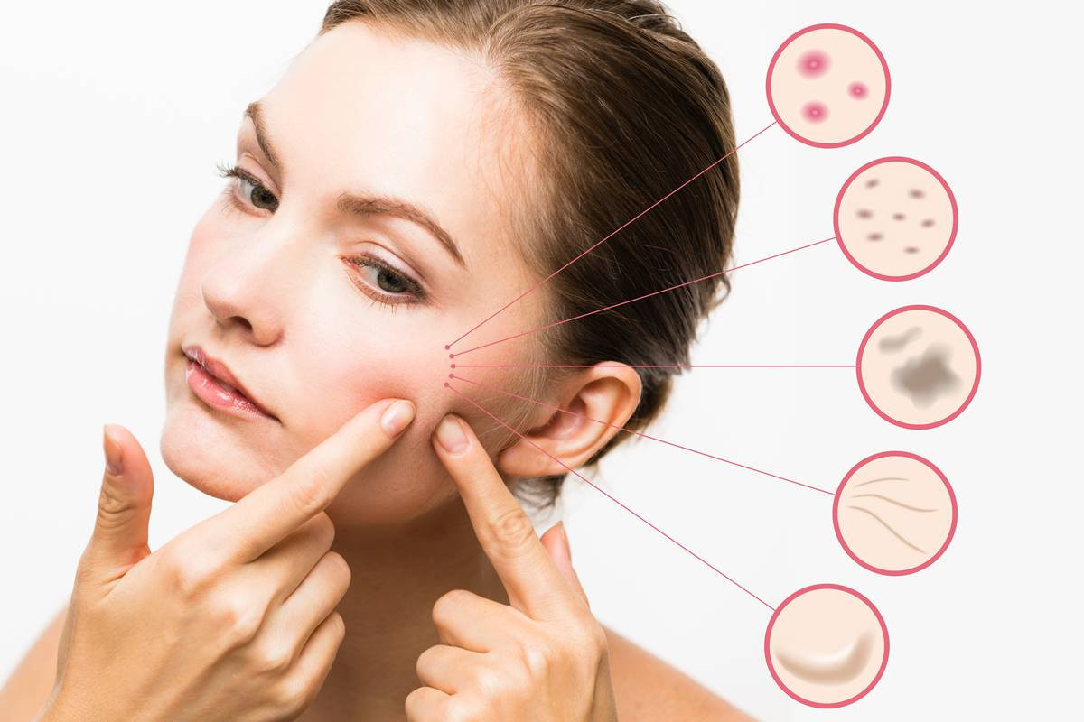 5 Common Skin Problems that You Must Not Ignore