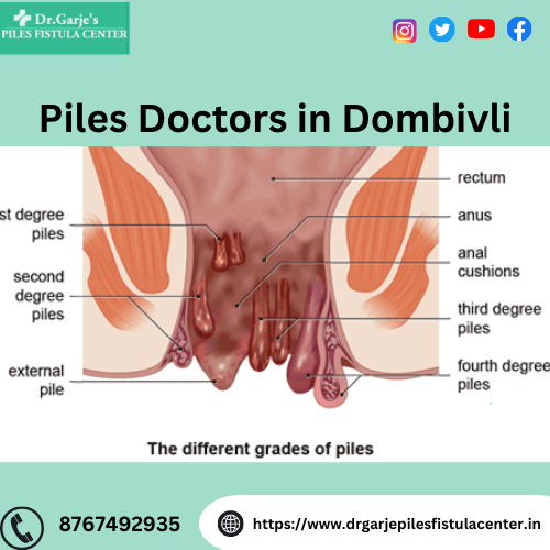 The Benefits Of Minimally Invasive Piles Treatments In Dombivli