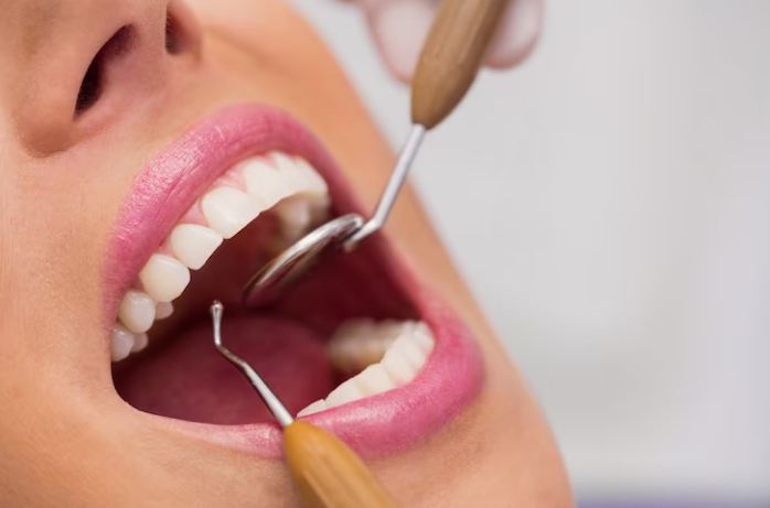 Cosmetic Dentistry: Enhancing Smiles and Boosting Confidence in Alexandria