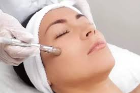 pros and cons of microneedling treatment