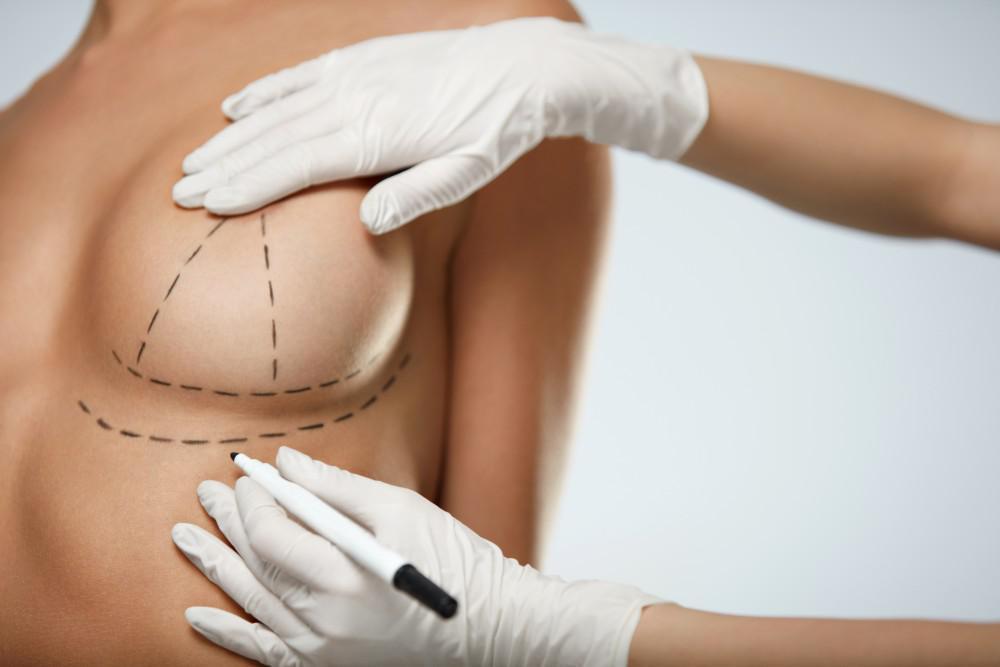 Boost Your Feminity With The Best Breast Reconstruction Surgeons