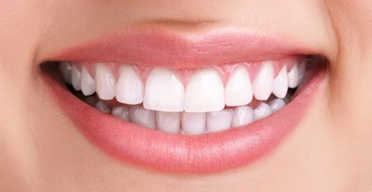 Teeth whitening kits vs. professional treatment in the UK
