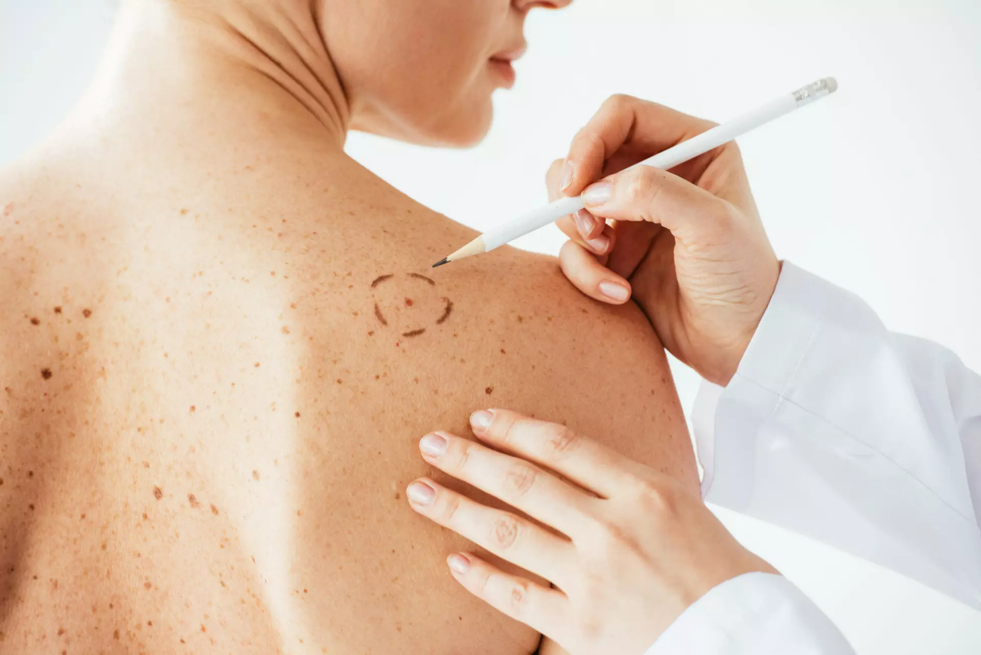 Accelerating Skin Health: The Fast Dermatologist Diagnosis Experience