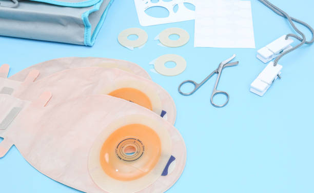 Beyond the Bag-Unleashing the Power of Other Ostomy Products