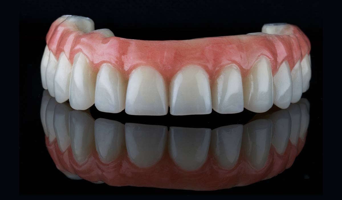 Affordable Dentures In London Ontario: An Extensive Overview | TechPlanet