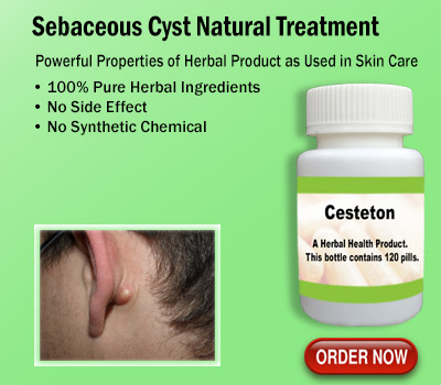 Infected Sebaceous Cysts Treatment: Navigating the Storm Beneath Your Skin