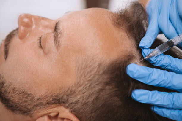 Revitalize Your Hair with PRP Hair Treatment in Riyadh