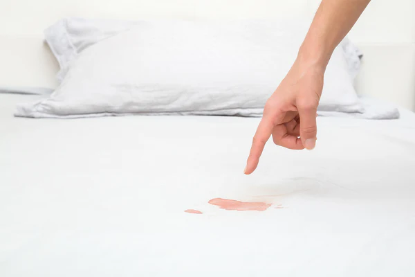 Stains, Sheets, and Solutions: Conquering Crimson Calamities on Your Bedding