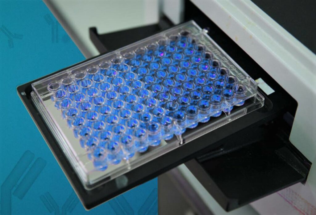 Exploring the World of Microplate Readers: Unveiling the Exceptional Offerings from Berthold