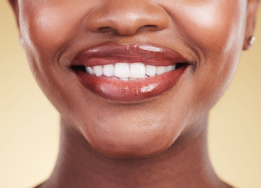 The Road to a Brighter Smile: Teeth Whitening Services in Richmond Hill
