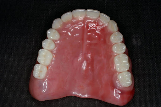 Where to Get Quality Dentures in GA for a Confidence-Boosting Smile
