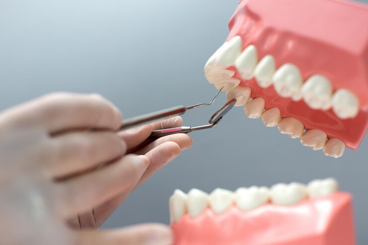 Your Guide to Dental Implants in Watertown, SD