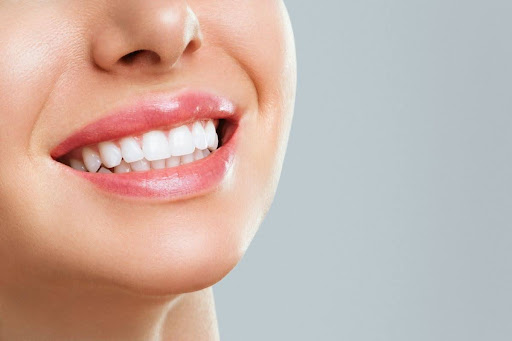 The Road to a Brighter Smile: Teeth Whitening Services in Richmond Hill