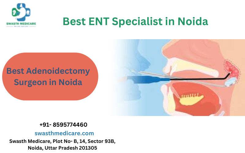 Best Adenoidectomy Surgeon in Noida