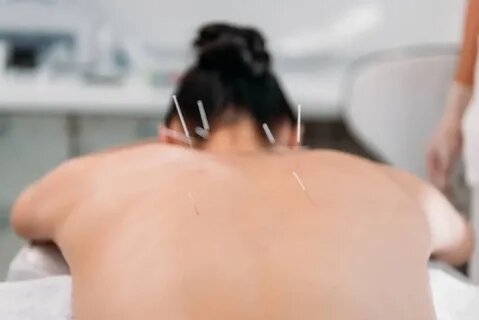 How to Choose the Best Acupuncture to Reduce Anxiety