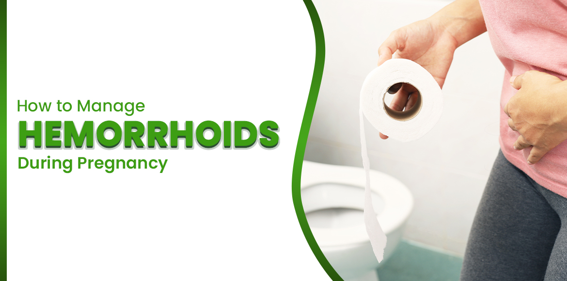 How to Manage Hemorrhoids During Pregnancy